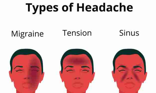 Migraine Headache